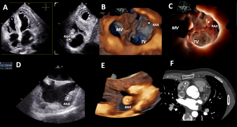 Italian Cardiologists Of Tomorrow tweet media