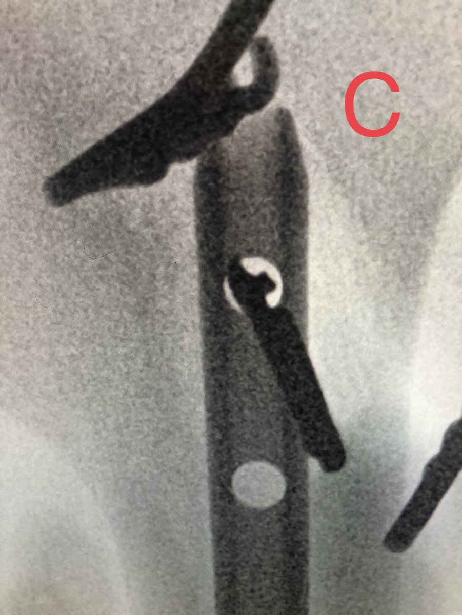 Yelena Bogdan, MD, FACS, FAAOS tweet media