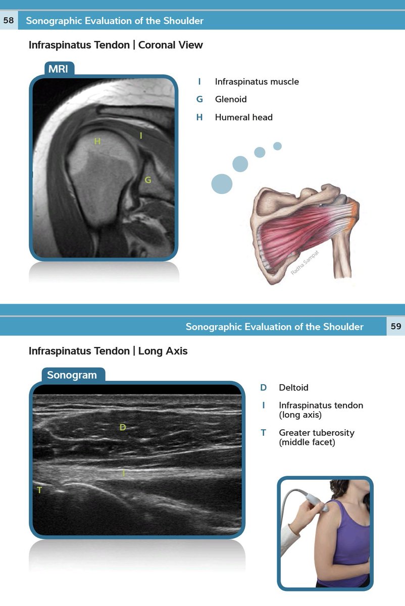 Rheumatology's tweet photo. FREE

Musculoskeletal Ultrasound Pocket Guide

https://t.co/ucKw3FQd7B https://t.co/rRU8eT9fRB