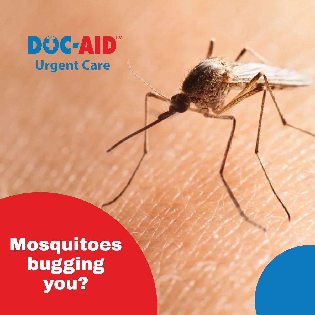 docaid_laredo's tweet photo. Summer's here! While that means fun in the sun, it also means mosquitoes and other troublesome bugs. If the bug spray doesn't do its job well, we'll handle it from there. Simply visit our urgent care center for help with insect bites. #mosquitoes #BitingInsects #InsectBites https://t.co/QROxys6eMV