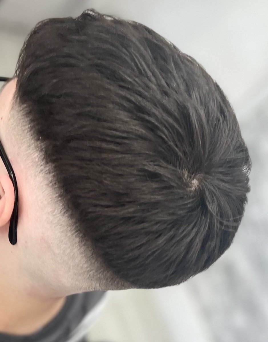ZiyBarber's tweet photo. Ziy med skin fade .💈💈

https://t.co/IKCdLUcZud

Ziy team. https://t.co/FvngjhPsME