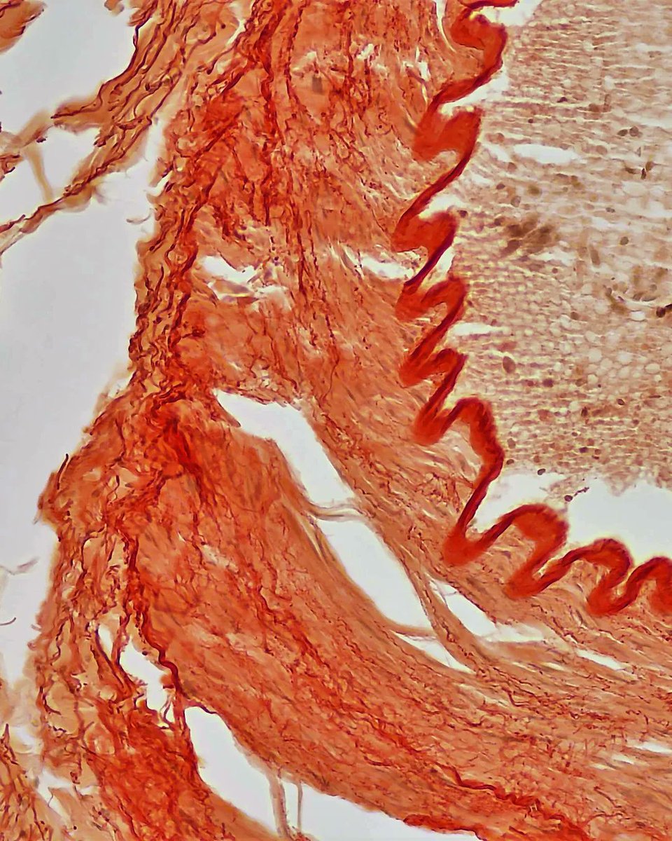 olkazuraw's tweet photo. Exploring the artistic aspect of special stains.

This is an artery stained with Congo Red.

I love the pattern the internal elastic membrane makes.

#microscopicphotography #pathart #specialstains #digitalart #nftart 
#Ilovehistology #Ilovepathology #digitalpathology #dppart https://t.co/1F9gDEkRf5