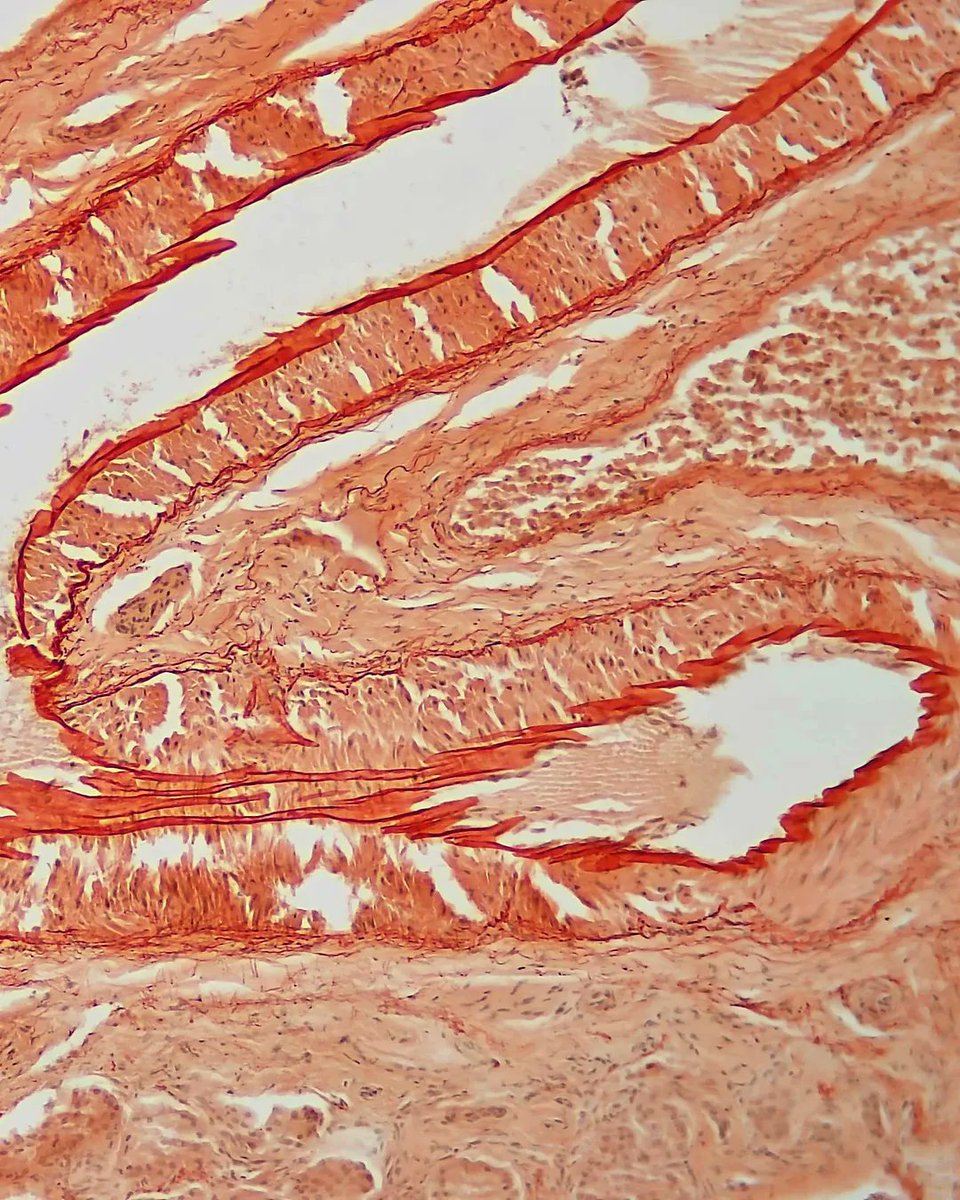 olkazuraw's tweet photo. Exploring the artistic aspect of special stains.

This is an artery stained with Congo Red.

I love the pattern the internal elastic membrane makes.

#microscopicphotography #pathart #specialstains #digitalart #nftart 
#Ilovehistology #Ilovepathology #digitalpathology #dppart https://t.co/1F9gDEkRf5