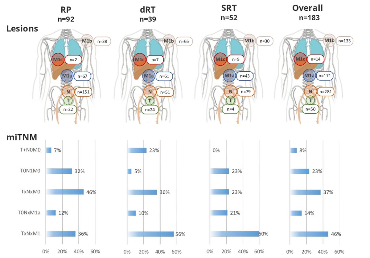 PSMA PET findings in an “EMBARK-like” cohort of HR nmHSPC <a href="/Wes_Armstrong_/">Wesley Armstrong</a> <a href="/CalaisJeremie/">Jeremie Calais</a> 

📌 n=183
📌 med PSA: 2.4 (RP), 6.9 (dRT), 2.7 (RP+SRT), 2.8 (overall pop)
📌 PSMA PET+: 85.2%; 609 PSMA PET+ lesions; 3.9 mean number of lesions/case. 46% M1 dx!

<a href="/urotoday/">UroToday.com</a> #ASCO23