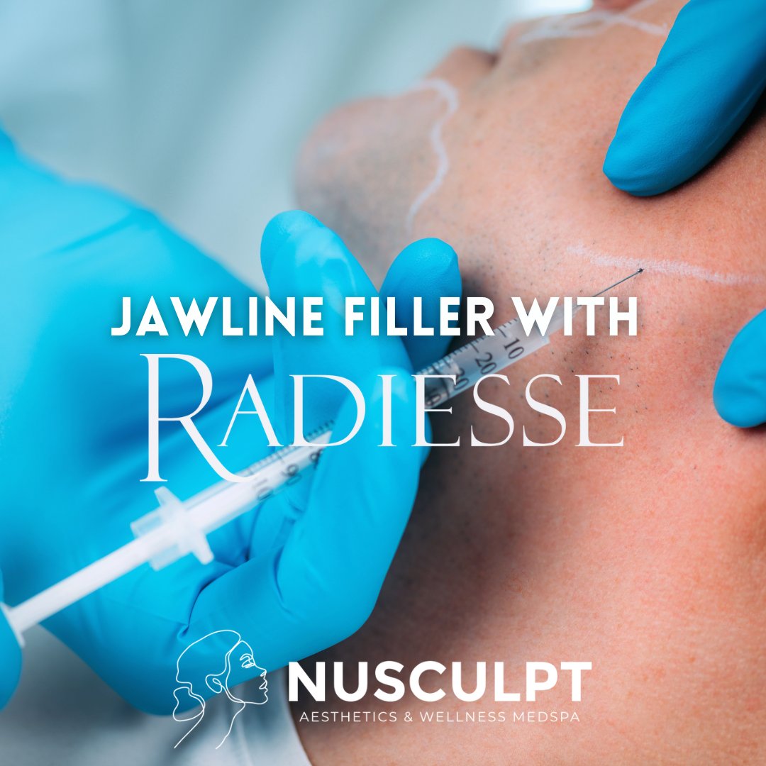 Carve Your Path to Sculpted Perfection with Radiesse Jawline Filler! 💪✨

Call us today or message us! 859-331-0555

#Nusculptcrestviewhills #NusculptKY #kentuckymedspa #medspa #RadiesseJawline #SculptedConfidence #JawlineFiller #Filler #Radiesse #Jawline