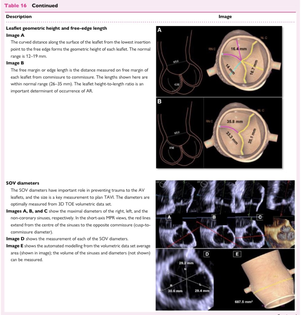 🔴 3-D transoesophageal echocardiography: how to use & when to use. Consensus Statement @ESC_Journals #CardioEd #Cardiology #Echofirst #CardioTwitter @robertomlang @Ivan_Echocardio @EACVIPresident