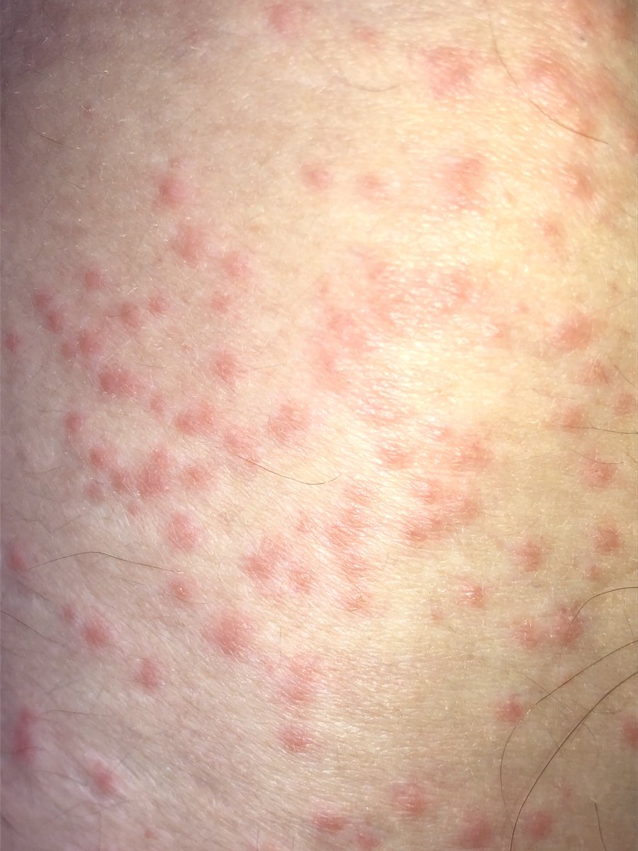 Noah Charney tweet media