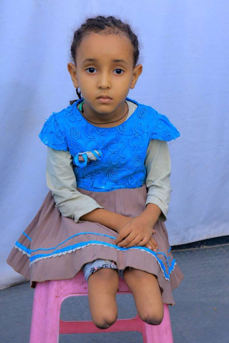 ኣምላክና ደቅና ይሓልወልና! ኣእምሮኦም፣ ኣካሎም፣.....
May God keep our children safe. May he heal them physically, mentally, spritually.