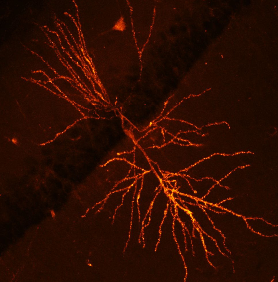 Doyeon Kim asked: how can we map all the synapses which got potentiated during a particular memory formation? i.e., what is the shape of a memory?
biorxiv.org/content/10.110…