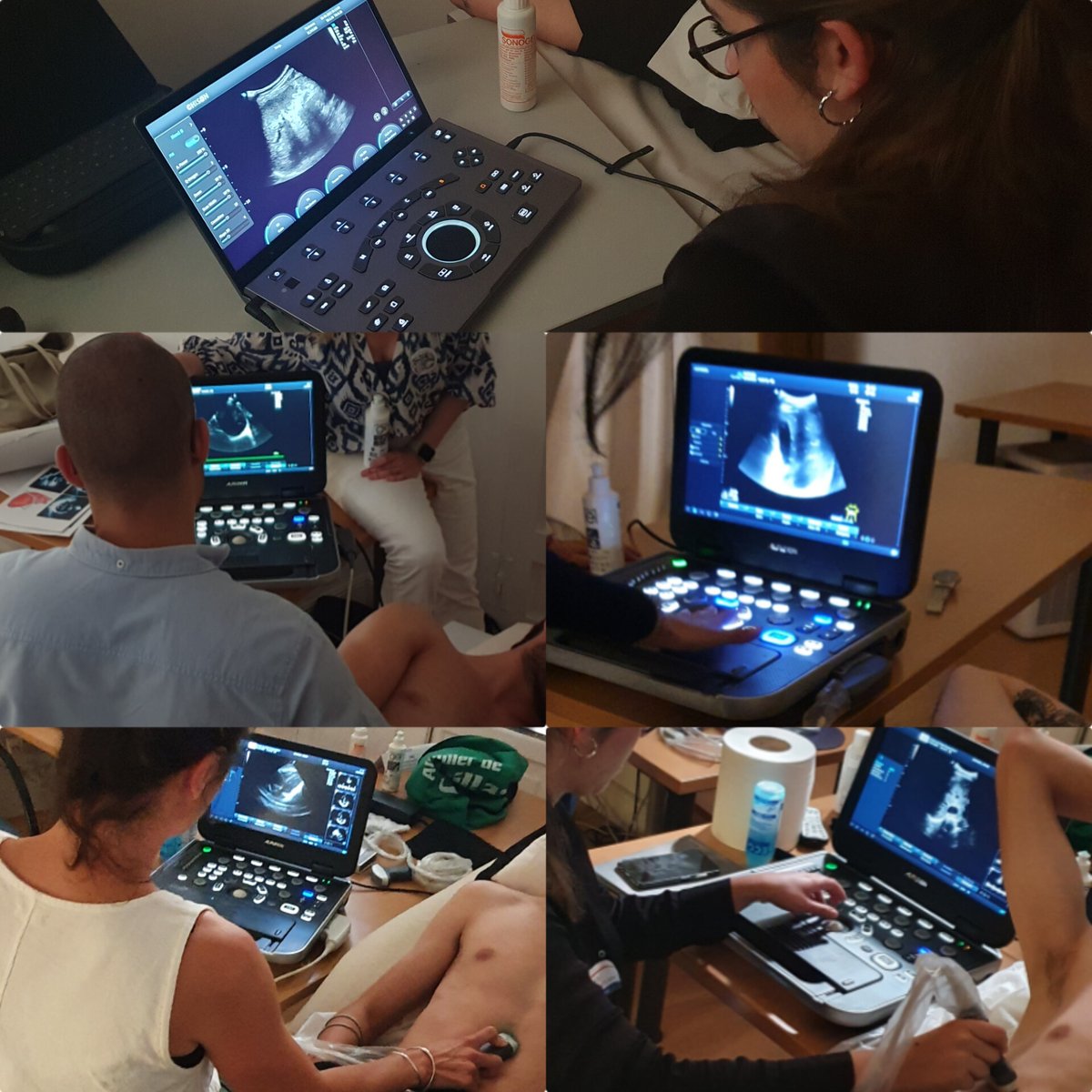 Nuestro agradecimiento a #Alpinion y #MedicalScan por su colaboración en las sesiones presenciales del Curso de Ecografía en Urgencias <a href="/semfyc/">semFYC</a> en Madrid 
#ecografos 
#POCUS <a href="/FAlpinion/">Francisco Martinez ALPINION</a>