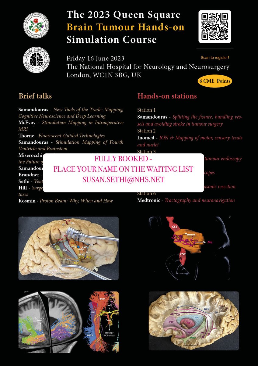 George Samandouras (@gsamandouras) on Twitter photo Place your name on the waiting list for a unique simulation workshop on brain tumour surgery in central London @ susan.sethi@nhs.net <a href="/QS_SimCentre/">Queen Square Simulation Centre</a> <a href="/trainthebest/">Masters of Neurosurgery</a> <a href="/e1v1m1/">BNTA</a> Place your name on the waiting list for a unique simulation workshop on brain tumour surgery in central London @ susan.sethi@nhs.net <a href="/QS_SimCentre/">Queen Square Simulation Centre</a> <a href="/trainthebest/">Masters of Neurosurgery</a> <a href="/e1v1m1/">BNTA</a>
