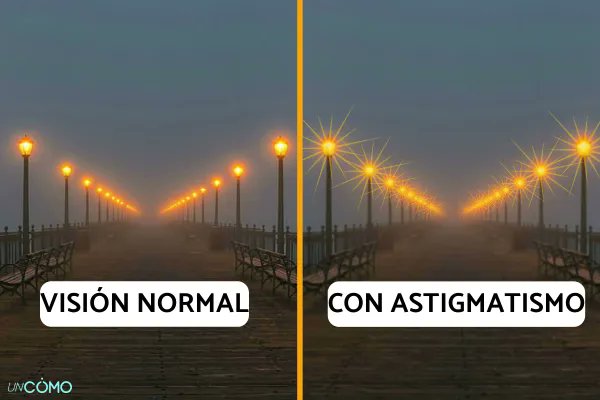 DoctorAsensio's tweet photo. Me acabo de enterar preparando el Final de Oftalmo que los destellos de luz que veo siempre es por mi astigmatismo y no es que todos ven las luces así 😐 https://t.co/NVps28xurh