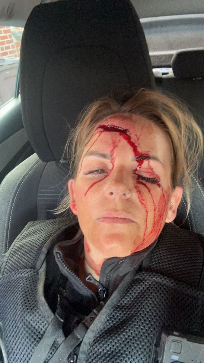 This is Sam, this week she was seriously assaulted whilst making an arrest and protecting the public 🤬 Yesterday the courts decided to bail the suspect sending out an astonishing message 🤔 Would you feel valued/supported doing your job if this was you? #ProtectTheProtectors