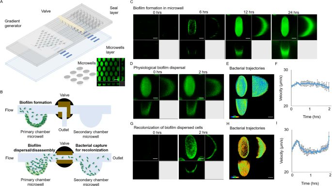 Akos T. Kovacs (@evolvedbiofilm) on Twitter photo Distinct bacterial population dynamics and disease dissemination after biofilm dispersal and disassembly
-in <a href="/ISMEJournal/">The ISME Journal</a>
#Pseudomonasaeruginosa #flowcellbiofilm
nature.com/articles/s4139… Distinct bacterial population dynamics and disease dissemination after biofilm dispersal and disassembly
-in <a href="/ISMEJournal/">The ISME Journal</a>
#Pseudomonasaeruginosa #flowcellbiofilm
nature.com/articles/s4139…