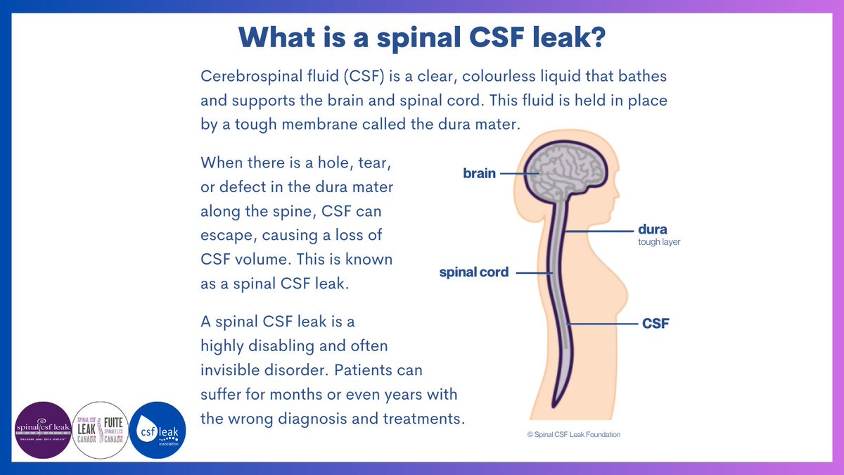 csfleakuk's tweet image. #csfleak #spinalcsfleak #SIH #LeakWeek2023
@spinalCSFleak @SpinalCSFCanada