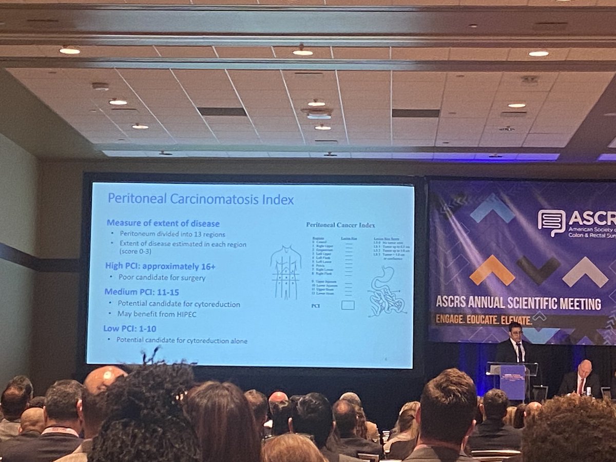 Adam Studniarek (@studniarek_adam) on Twitter photo Full house for Jelly in the Belly session!Excellent summary of CRS+/-HIPEC data for CRC patients by <a href="/NelyaMel/">Nelya Melnitchouk MD 🇺🇦🌻🇺🇦🌻</a> <a href="/heatheryeomd/">Heather Yeo MD</a> <a href="/DrMikeValente/">Michael A. Valente</a> <a href="/GaertnerWB/">Wolfgang Gaertner</a> <a href="/MSKCancerCenter/">Memorial Sloan Kettering Cancer Center</a> <a href="/ASCRS_1/">ASCRS_1</a> Full house for Jelly in the Belly session!Excellent summary of CRS+/-HIPEC data for CRC patients by <a href="/NelyaMel/">Nelya Melnitchouk MD 🇺🇦🌻🇺🇦🌻</a> <a href="/heatheryeomd/">Heather Yeo MD</a> <a href="/DrMikeValente/">Michael A. Valente</a> <a href="/GaertnerWB/">Wolfgang Gaertner</a> <a href="/MSKCancerCenter/">Memorial Sloan Kettering Cancer Center</a> <a href="/ASCRS_1/">ASCRS_1</a>