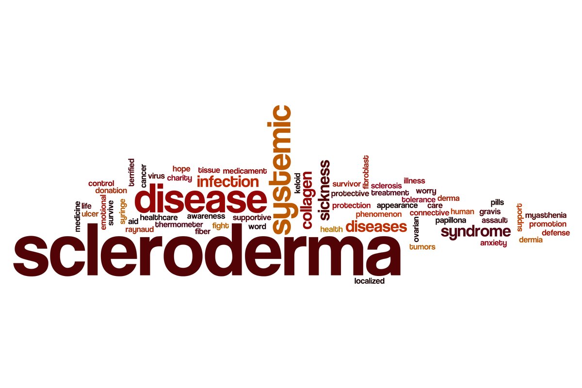 SummaHealth's tweet image. Scleroderma is a rare & often misunderstood autoimmune disease affecting the connective tissues in the body. It causes thickening & hardening of the skin & internal organs, as well as joint pain & fatigue. We'e helping raise awareness for this disease.
#SclerodermaAwarenessMonth