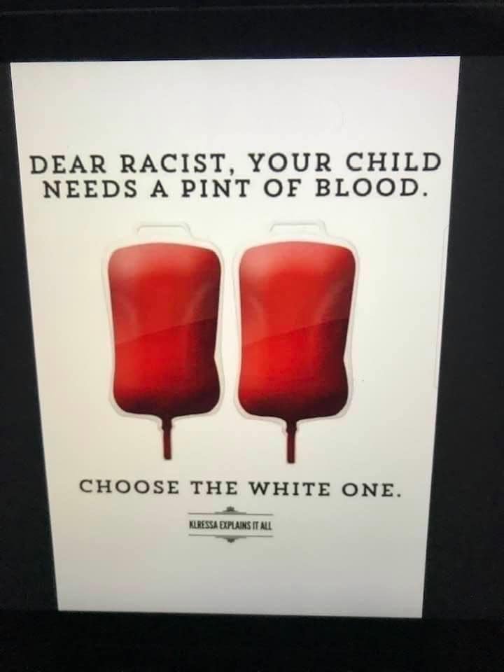 Why do we judge by skin color, we all the Same underneath.