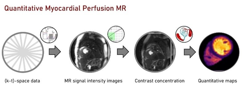 Join " The Chest Pain Chess Game" on Monday 8:15am♟❤ <a href="/ISMRM/">ISMRM</a> @SMRT_ISMRM
🙋🏻‍♀️ I'll be talking about Quantitative perfusion CMR 🧲🔢

...&amp; check out the CMR Rodeo 🤠🐴 on Wed 2:45pm. <a href="/KuestnerThomas/">Thomas Kuestner</a> and I will be handing out some 🎁

#whyCMR #ISMRM_Iberian #ISMRM23 <a href="/CienciasDoMar/">CCMAR - Centro de Ciências do Mar</a>