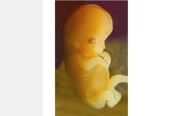 LifeNewsHQ's tweet image. Harvard Law Journal Concludes Unborn Babies Have Constitutional Rights buff.ly/2AI8cNH