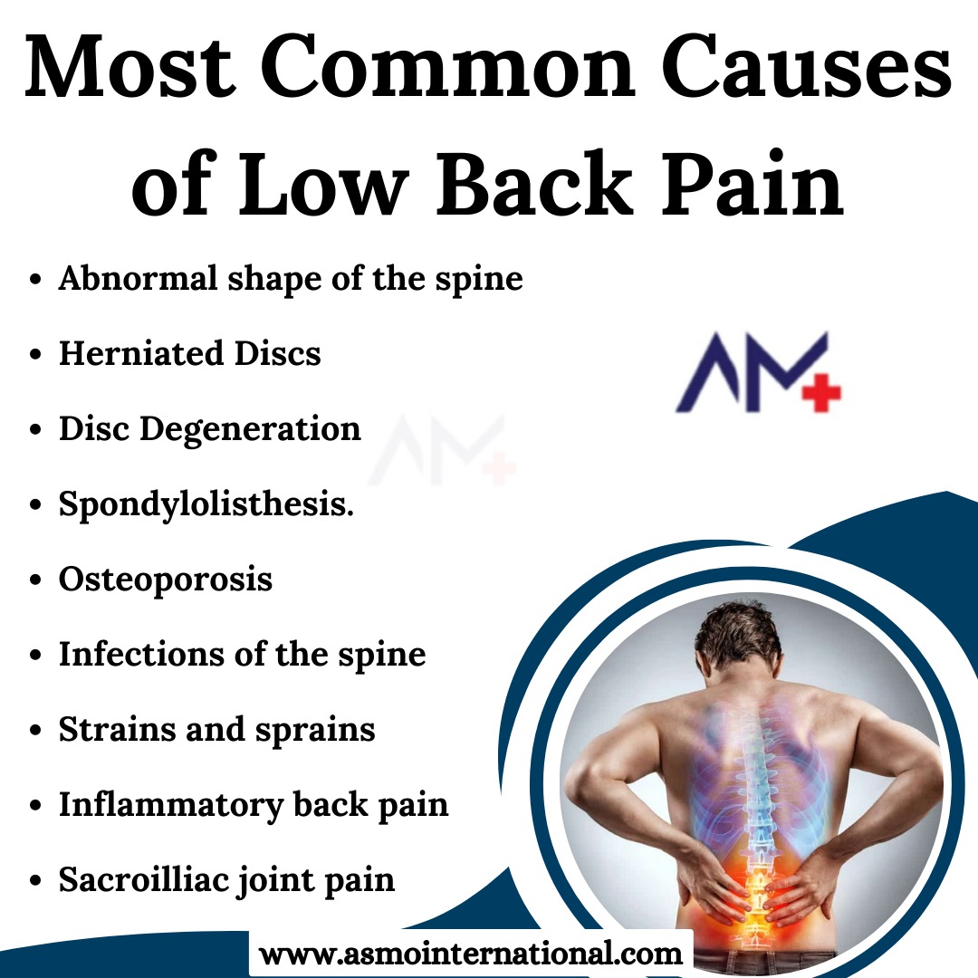 Most Common Causes of Low Back Pain
.
bit.ly/3nHERKo
.
#backpain #neckpain #health #painrelief #wellness #backpainrelief #lowbackpain #shoulderpain #healthy #selfcare #healthcare #asmointernational #asmohealth #asmomedicines #asmocare #asmoresearch #asmo