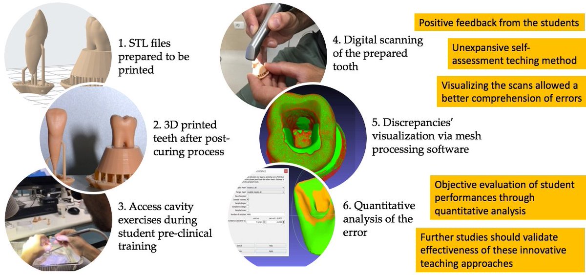 #mdpidentistry
A Novel Self-Assessment Method for Training Access Cavity on #3D Printed #Endodontic Models
From: University of Parma @unipr, and IMEM-CNR
mdpi.com/2304-6767/11/6…
#dentaleducation #3dprinting #intraoralscanner
@MDPIOpenAccess @MediPharma_MDPI @DentistryJ