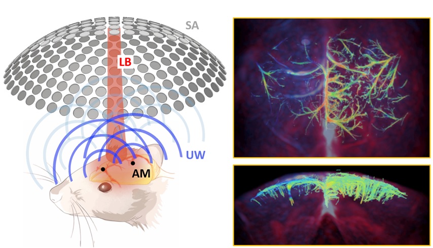 We break through both optical diffusion and ultrasound diffraction limits with optoacoustic localization microangiography employing extremely absorbing microparticles. Congrats to Luís Deán-Ben and all the collaborators for extraordinary teamwork !!      nature.com/articles/s4146…