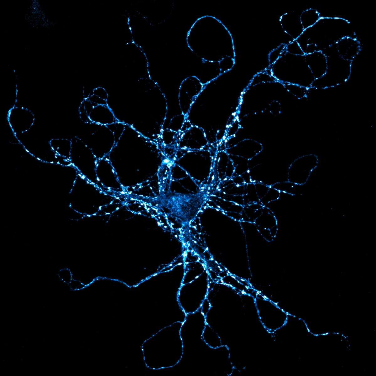 Encephalon2023's tweet photo. #MicroscopyMonday: Synaptophysin in a neuron differentiated from hiPSCs  in collaboration with the Lab of @MariaPatapia Zafeiriou. Join us on 7th December to also mature yourself into a neurodev-enthusiast! #Encephalon2023 #conference #neurodevelopment https://t.co/FEyNPQY2m8