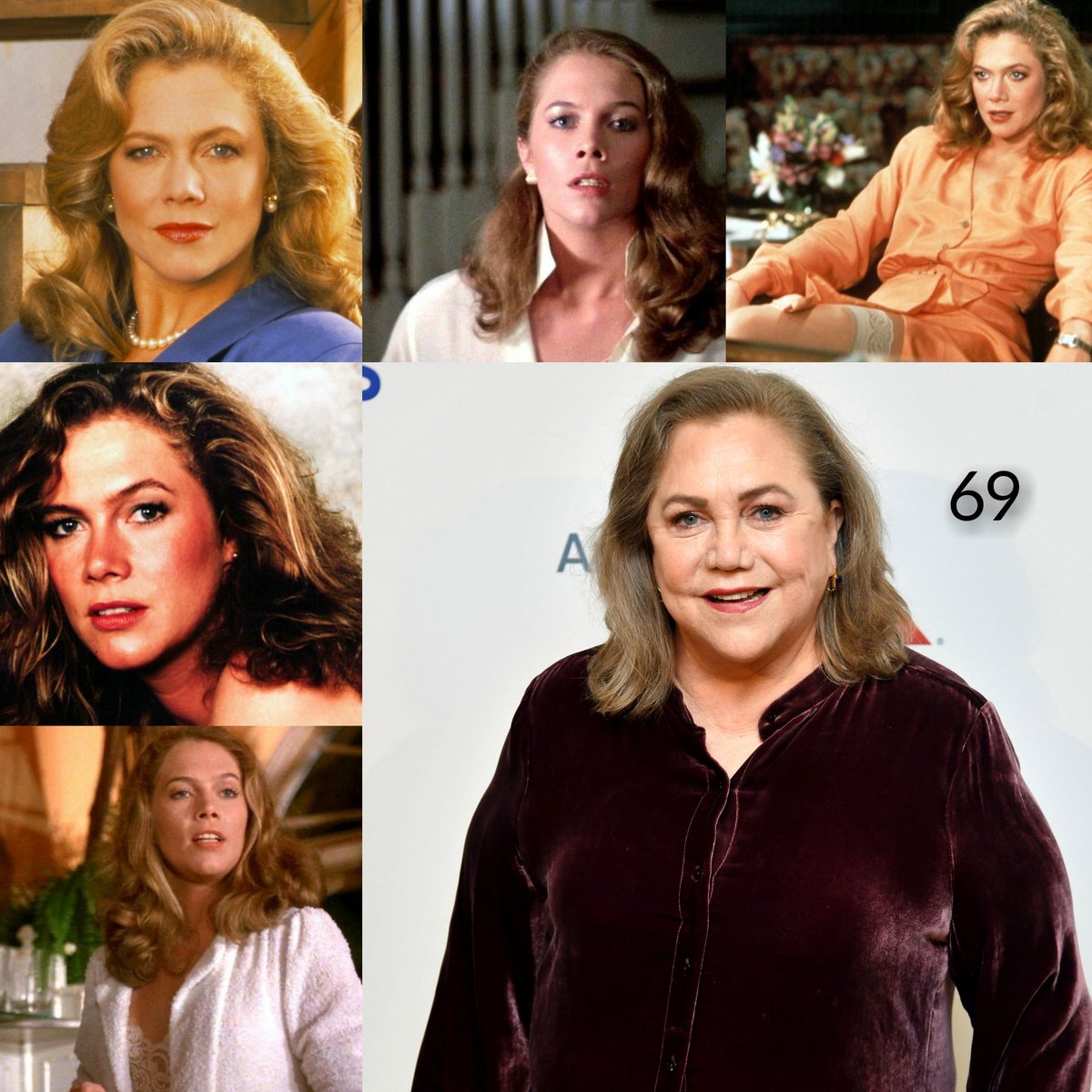 Hoy cumple #KathleenTurner (69 - Springfield, Misuri🇺🇲)
Felicidades 🎉🎂🎉
Diagnosticada a principios de los 90 con artritis reumatoidea y sumado a fármacos para remitar el dolor + adicción al alcohol terminó por derrumbar su exitosa carrera