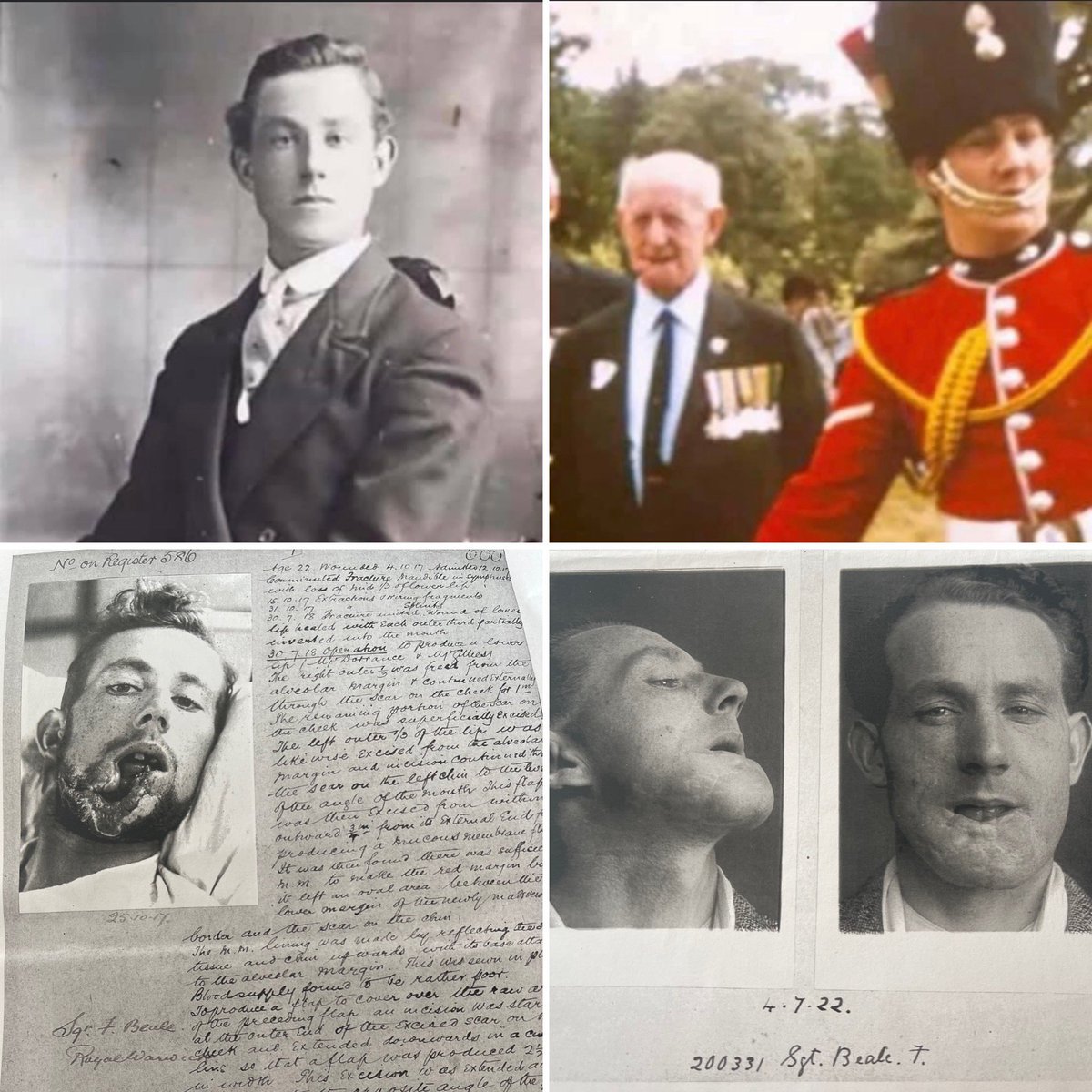 @DrLindseyFitz - reading your book - The Facenaker puts it all into context what my great uncle went through after his injuries at the Somme in 1917 aged just 22. His surgery and rehabilitation at Sidcup, Kent. Thank you for remembering their lives 💙
#Firstworldwar #Somme