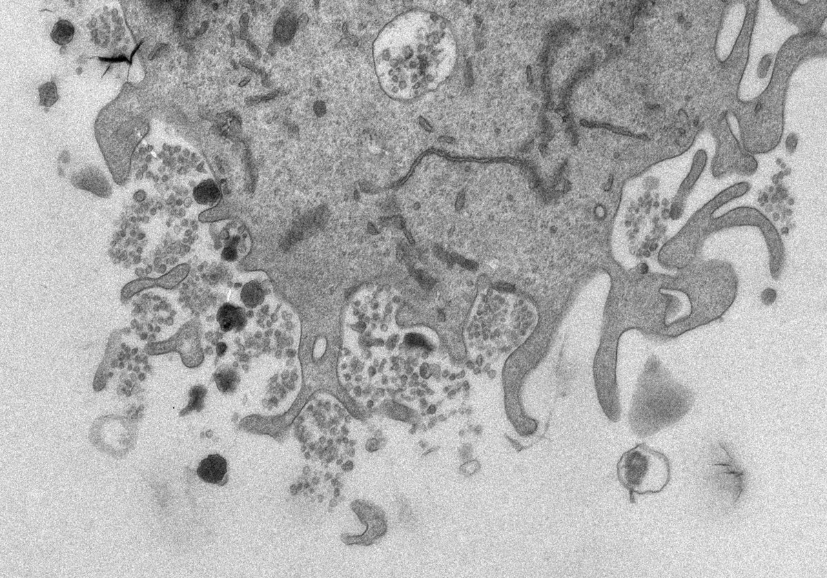 Interested in cell biology? Curious about endosomes / exosomes / membrane trafficking? We are looking for a postdoctoral researcher to join our lab to understand how and why cells tether exosomes to their cell surface. Fun projects on offer! jobs.cam.ac.uk/job/41225/