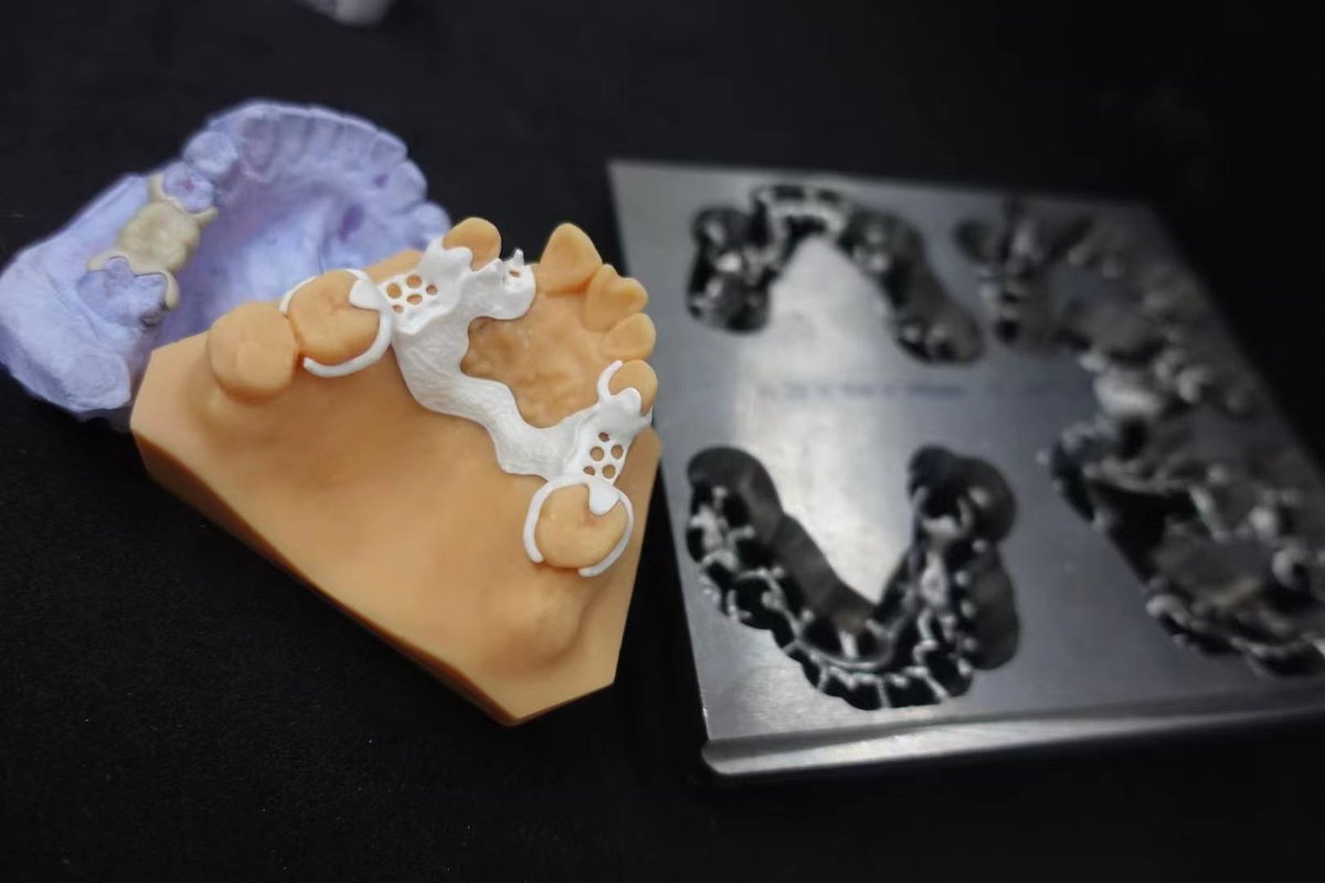 Beckydentallab's tweet image. #peek #metalframework #CCP