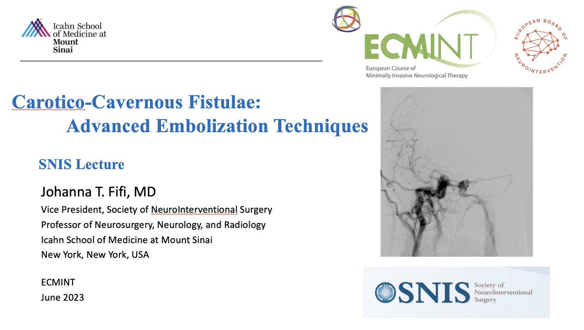 Johanna T. Fifi, MD (@johannatfifi) on Twitter photo Delighted to represent <a href="/SNISinfo/">SNIS Info</a> at the #ECMINT 5.1 course on Neurovascular disease of the skull base - sharing my passion for CCF embolization. <a href="/esmintsociety/">ESMINT Society</a> <a href="/MountSinaiCVC/">Mount Sinai Cerebrovascular</a> <a href="/DrAdamRennie/">Adam Rennie</a> <a href="/meyerspm/">Philip Meyers</a> <a href="/JMoccoMD/">J Mocco, MD, MS</a> Delighted to represent <a href="/SNISinfo/">SNIS Info</a> at the #ECMINT 5.1 course on Neurovascular disease of the skull base - sharing my passion for CCF embolization. <a href="/esmintsociety/">ESMINT Society</a> <a href="/MountSinaiCVC/">Mount Sinai Cerebrovascular</a> <a href="/DrAdamRennie/">Adam Rennie</a> <a href="/meyerspm/">Philip Meyers</a> <a href="/JMoccoMD/">J Mocco, MD, MS</a>