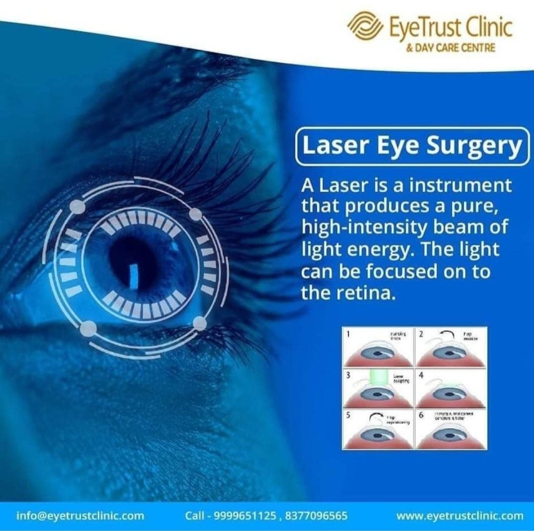 Most Advanced Equipment, Laser Eye surgery at Affordable Cost. Super Specialized Surgeon. 
Contact: (+91)-9999651125, (+91)-8377096565
Visit:eyetrustclinic.com
#eyetrustclinic #eyedisease #lasersurgery #visionproblems #eyesurgery