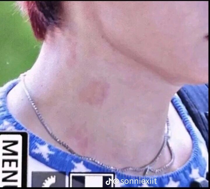 lexishii_'s tweet photo. Who did this to u, prob hannie🤨 
#FYP #skznsfw #LeeKnow https://t.co/WLDuZQ3gg1