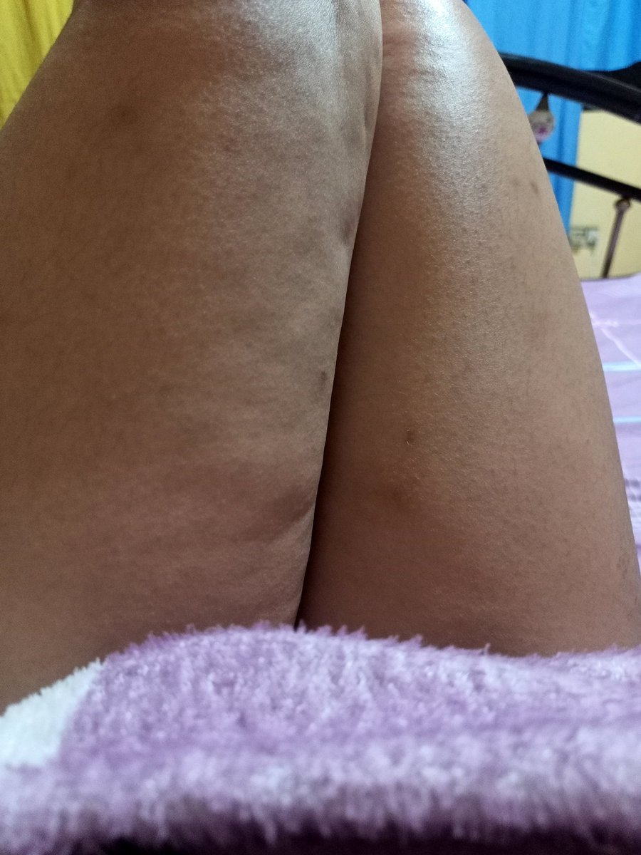 kittywittyfeet's tweet photo. Do people like cellulite? https://t.co/u0bLIYDUqX