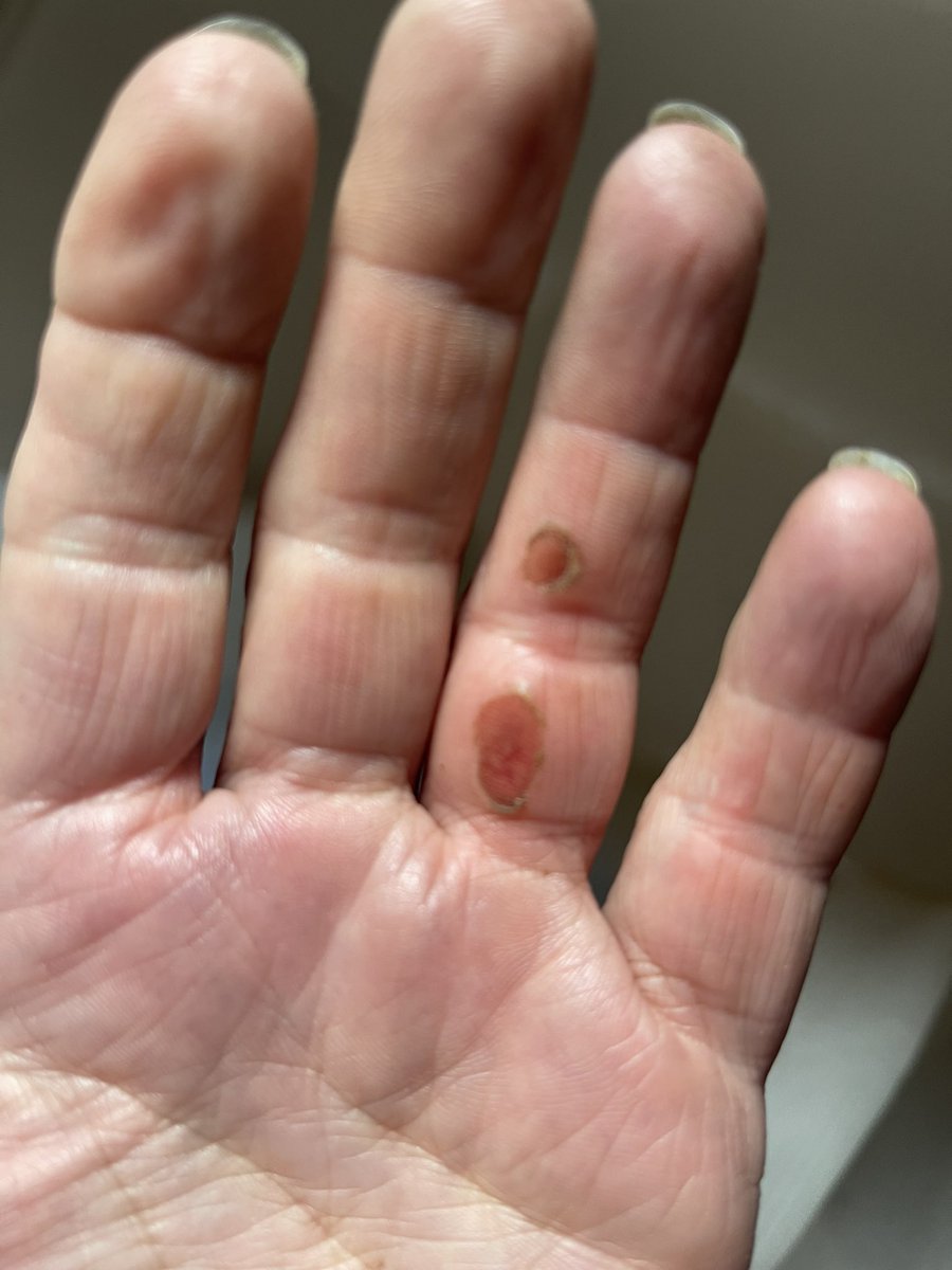 Swiss_Cathy's tweet photo. Que de luttes, la jeune Dame m’a fait rudement plaisir en montrant son potentiel. #Bacchanale , je suis très fière de toi. ⛰️🐮💪🏼🥰
ps : main gauche out, cause licol.🔥😅
#maPrincesse #mavache #primipare #hérens #ceciestunehérens #inalpe #emmontagnée #alpage #Thyon #Valais https://t.co/9HUCsGPOC0