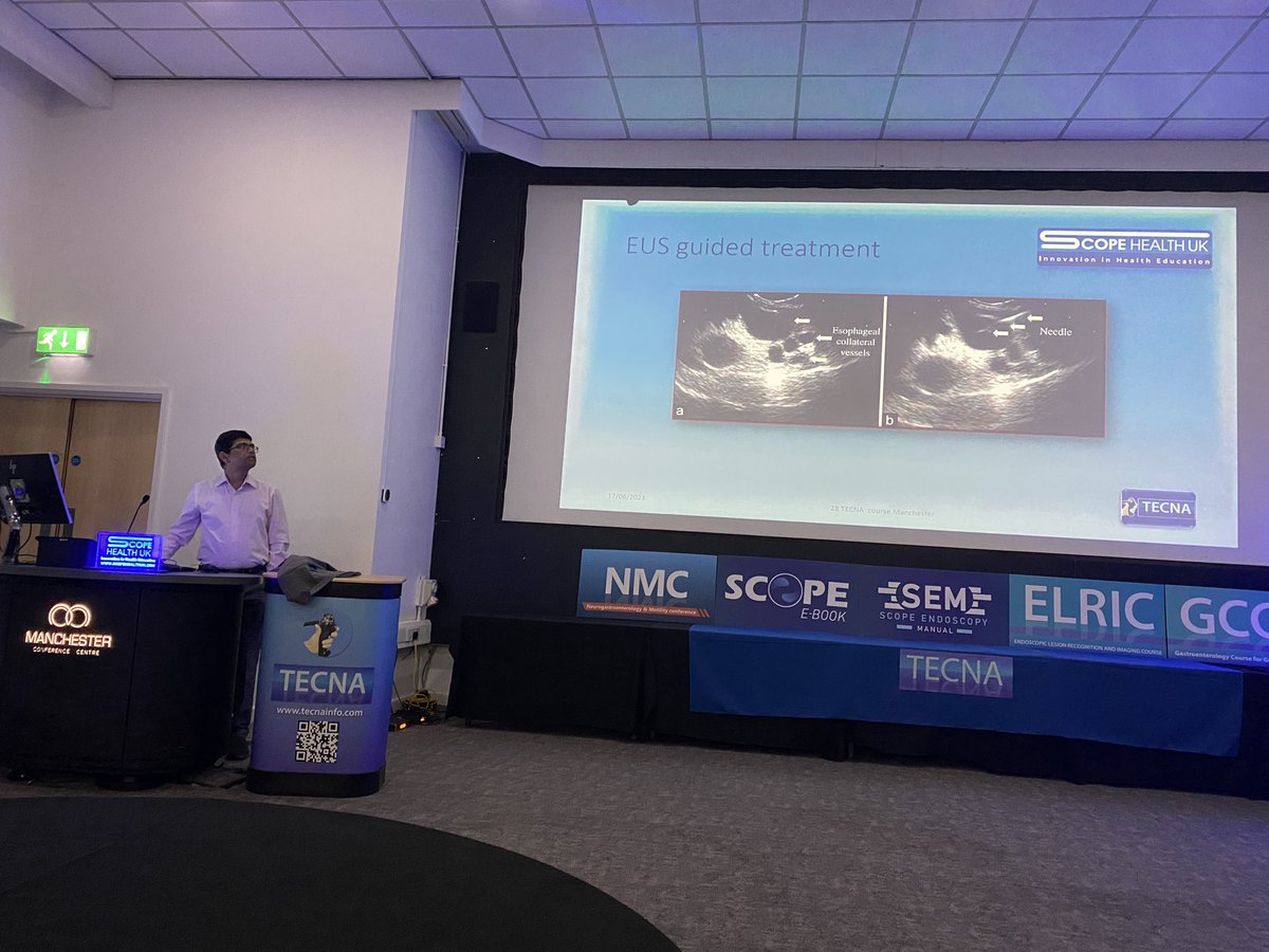 Ramesh Shanker MD(Res) (@rameshshan777) on Twitter photo Pawan is talking about variceal bleeding management <a href="/ScopeHealthUK/">SCOPE COURSES @SCOPEHEALTHUK</a> <a href="/BSGNurses/">BSG Nursing</a> <a href="/ESGENAnurses/">ESGENA</a> Pawan is talking about variceal bleeding management <a href="/ScopeHealthUK/">SCOPE COURSES @SCOPEHEALTHUK</a> <a href="/BSGNurses/">BSG Nursing</a> <a href="/ESGENAnurses/">ESGENA</a>