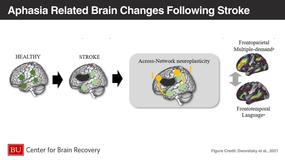 Center for Brain Recovery (@aphasialab) on Twitter photo In an exciting collaboration with <a href="/ev_fedorenko/">Ev (like in 'evidence', not Eve) Fedorenko 🇺🇦</a> <a href="/Annel3illoT/">Anne Billot, PhD, @annebillot.bsky.social</a> <a href="/MVarkanitsa/">Maria Varkanitsa</a> <a href="/isaacfalconer/">Isaac Falconer @isaac.falconer.bsky.social</a> and others are looking at how different #brain regions engage in their response to #language and #cognitive processing. Read here bu.edu/cbr/2023/06/14… In an exciting collaboration with <a href="/ev_fedorenko/">Ev (like in 'evidence', not Eve) Fedorenko 🇺🇦</a> <a href="/Annel3illoT/">Anne Billot, PhD, @annebillot.bsky.social</a> <a href="/MVarkanitsa/">Maria Varkanitsa</a> <a href="/isaacfalconer/">Isaac Falconer @isaac.falconer.bsky.social</a> and others are looking at how different #brain regions engage in their response to #language and #cognitive processing. Read here bu.edu/cbr/2023/06/14…