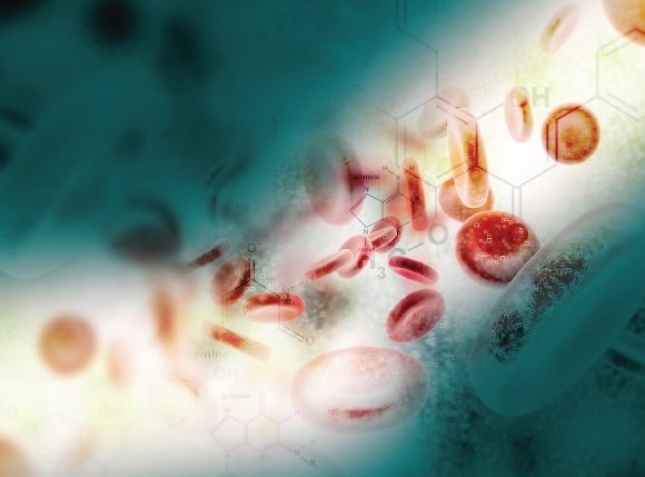 OncologyTimes's tweet image. Research at #EHA2023 provided a closer look at disease progression and leukemic transformation among patients with lower-risk #myelofibrosis. Data showed about one-third of patients had progressive disease. ow.ly/J8Tt50OQGVp