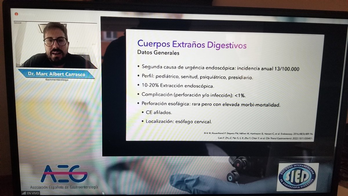 Comenzando ahora la 1a. Jornada de casos endoscópicos SIED-AEG Moderado por el coordinador de los jovenes SIED Dr. Carlos Baubet y la vocal de endoscopia de AEG, la Dra. Noelia Alonso. 
Comenzamos con Marc Albert con un caso de perforación esofágica