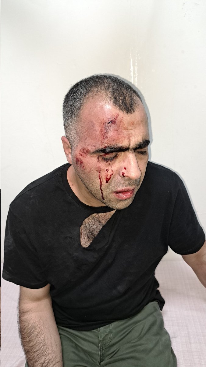 Gazeteci Sinan Aygül'e az önce ulaştım. Konuşamayacak vaziyette. Resmen öldürmeye teşebbüs edilmiş! Bu vahşete herkes sesini çıkartmalı! Küçük çocukları var! Kimse bu muameleyi hak etmiyor! Tatvan Belediye Başkanı ve korumaları hakkında inceleme başlatılmalı! <a href="/AliYerlikaya/">Ali Yerlikaya</a>