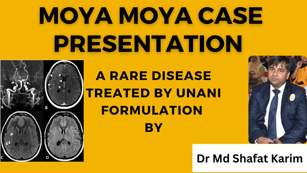 shafatkarim's tweet photo. https://t.co/vvj8tid3do
#moyamoya #shafat #hakim #unani 
A cured case of Moya Moya Disease https://t.co/UIqKNTqAlI