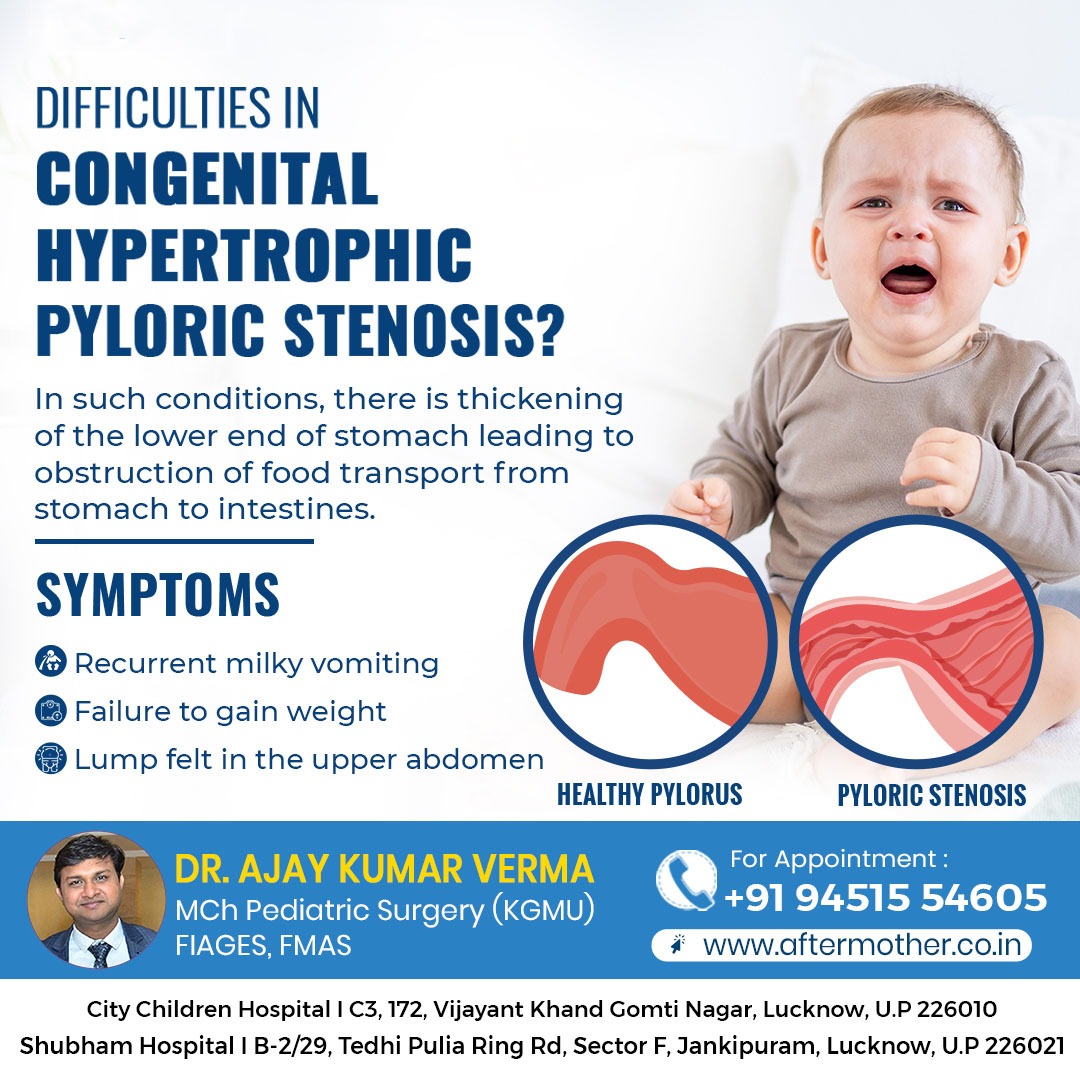 DrAjayKumarVer6's tweet photo. Dr. Ajay Verma
Consultant Neonatal and Pediatric Surgeon MBBS,MS,MCh.Pediatric Surgery(KGMU,Lucknow) FIAGES,FMAS
https://t.co/4FqaGwAXZz
#PosteriorUrethral #Urethralvalve #kidsproblem #childworm #babycare #childcancer #pediatricurologists #lucknow https://t.co/HzByvpSKIW
