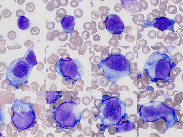 Benlazar S M A tweet media