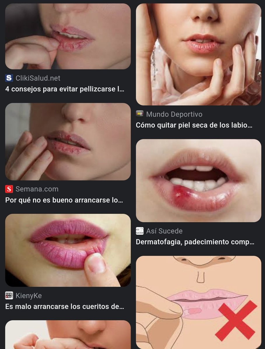 no tengo autocontrol: