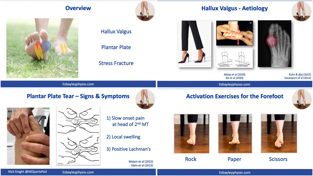 Liz Bayley (@lizbayleyphysio) on Twitter photo If you want to learn something, teach it 🤓 Spent my Saturday finishing my presentation for the amazing THERAPY LIVE with <a href="/TPMPodcast/">Physio Matters</a> a week today! My talk; Rehabilitating the Forefoot🦶🏼🏋🏼♀️ Loads of incredible speakers & subjects! Tickets 🎟️ physio-matters.com/therapy-live-2… If you want to learn something, teach it 🤓 Spent my Saturday finishing my presentation for the amazing THERAPY LIVE with <a href="/TPMPodcast/">Physio Matters</a> a week today! My talk; Rehabilitating the Forefoot🦶🏼🏋🏼♀️ Loads of incredible speakers & subjects! Tickets 🎟️ physio-matters.com/therapy-live-2…