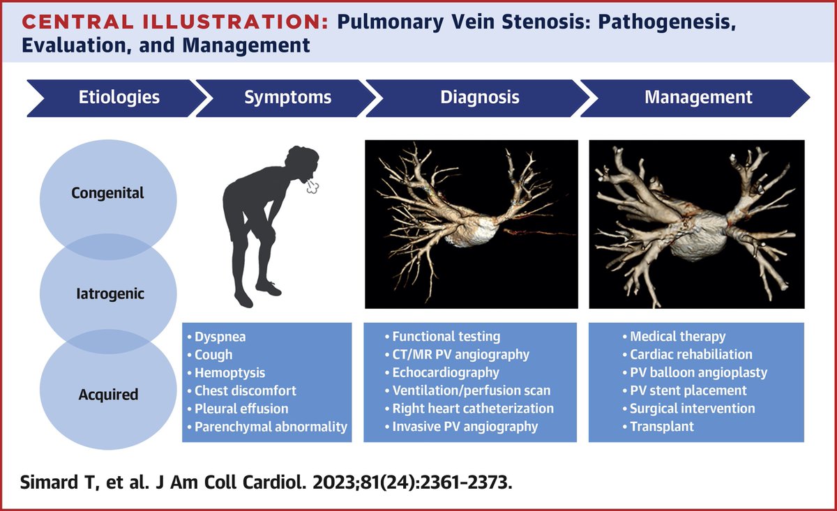 Pulmonary vein stenosis can arise from several etiologies, including congenital, acquired & iatrogenic sources. PVS presents insidiously, leading to significant delays in diagnosis. Read more on PVS in #JACC: bit.ly/3CvKapJ