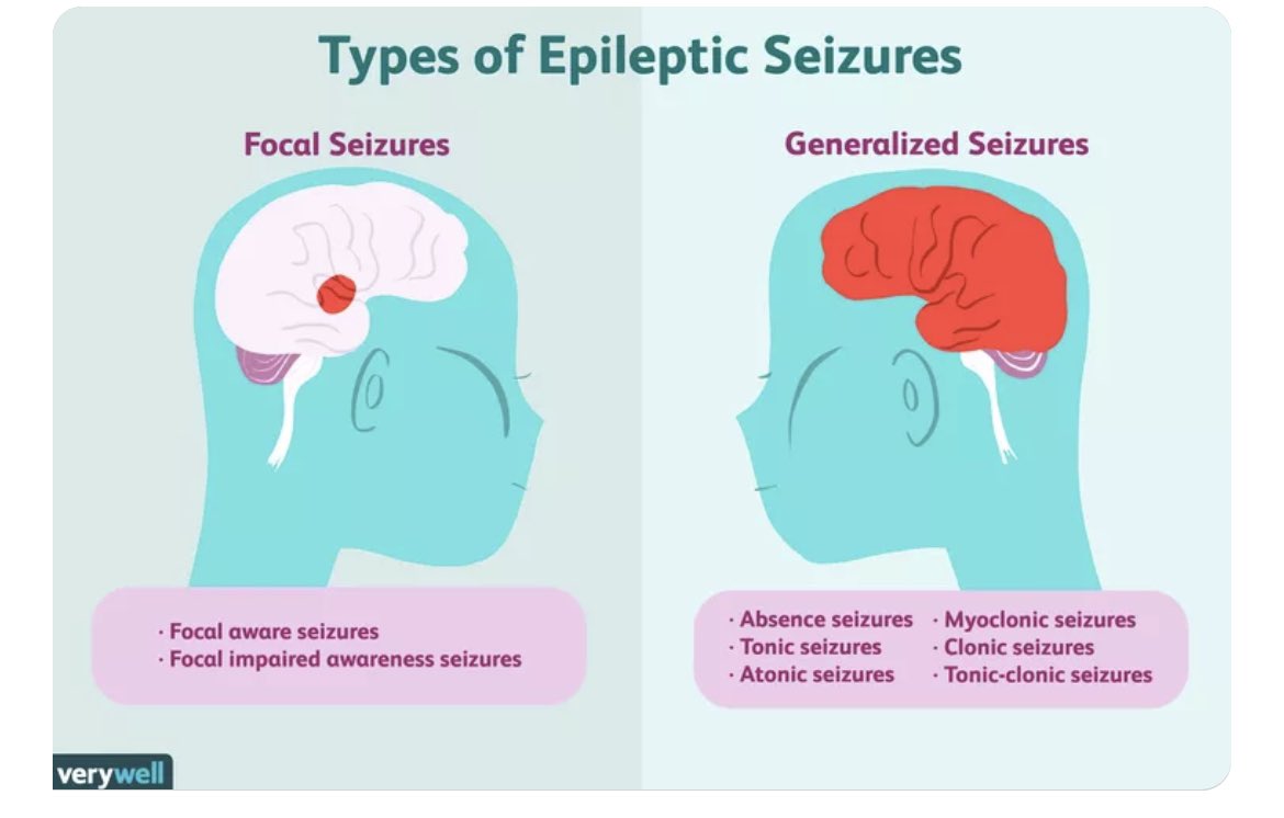 Types of #epilepsy seizures 🧠 <a href="/Verywell/">Verywell Health</a>