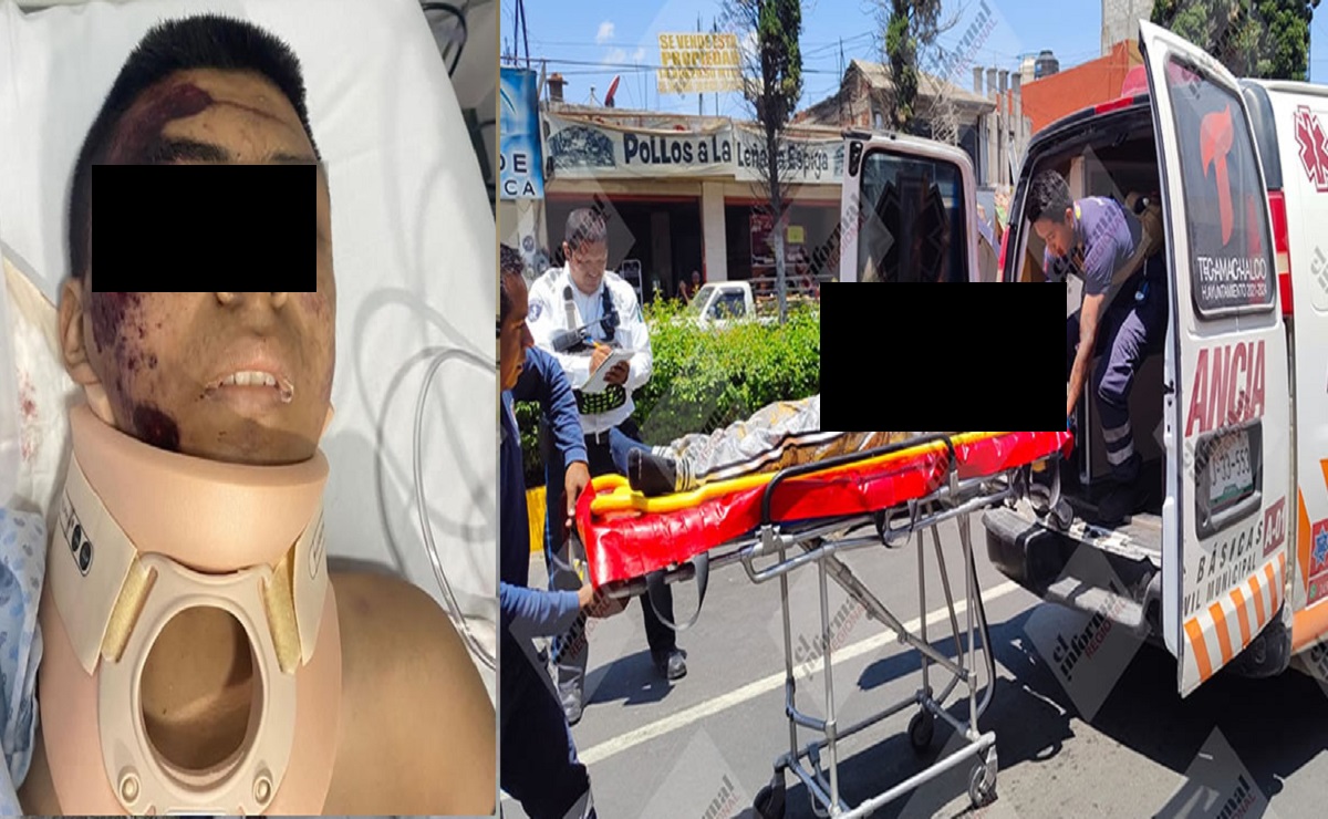 PueblaenLinea's tweet photo. Atropellan y matan a Chuchín; jovencito de 16 años que intentaba cruzar la calle  https://t.co/ARW5lTkIX5 https://t.co/UXBbhcq9Lg